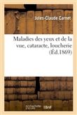 Maladies des yeux et de la vue, cataracte, loucherie