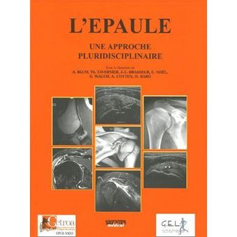 L'epaule une approcje pluridisciplinaire