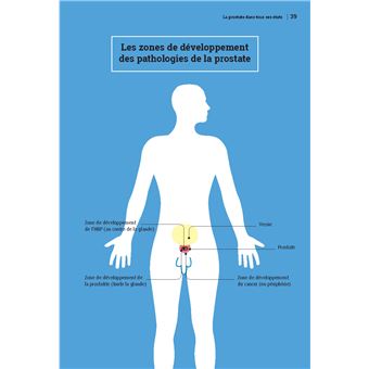 Prostate, on vous dit tout !