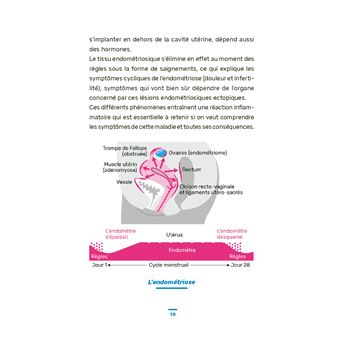 L'endométriose