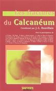 Les fractures du calcaneum