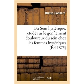 Du Sein hystérique, étude sur le gonflement douloureux du sein chez les femmes hystériques