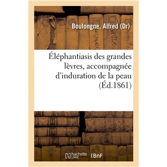 Éléphantiasis des grandes lèvres, accompagnée d'induration de la peau