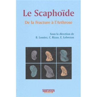 Le scaphoide