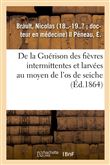 De la Guérison des fièvres intermittentes et larvées au moyen de l'os de seiche