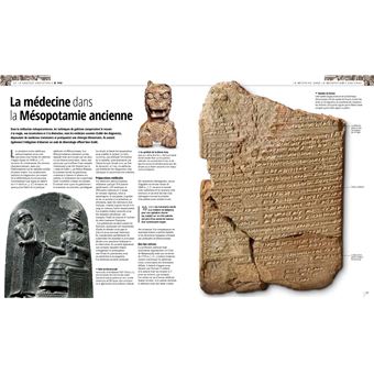 Médecine, histoire illustrée de l'Antiquité à nos jours