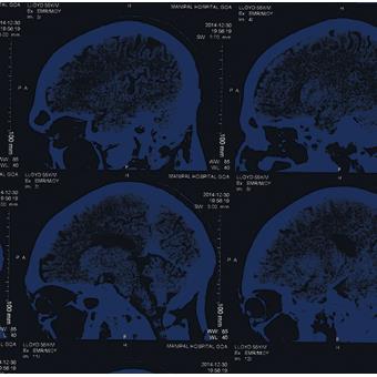 The Nightingales - 1