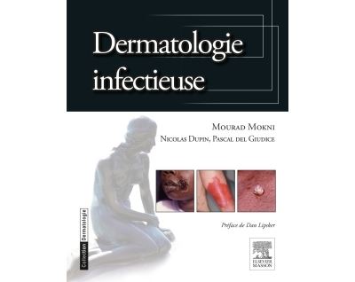 Dermatologie infectieuse