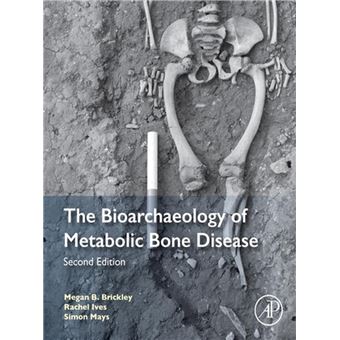The Bioarchaeology of Metabolic Bone Disease - ebook (ePub) - Megan B ...