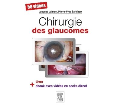 Chirurgie des glaucomes