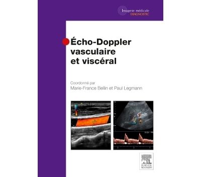 Echo-doppler vasculaire et viscéral