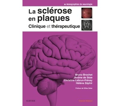 La sclérose en plaques - Clinique et thérapeutique
