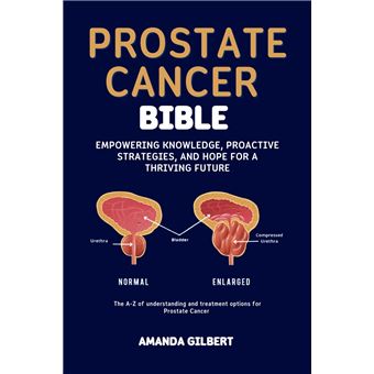 https://static.fnac-static.com/multimedia/Images/FR/NR/62/cf/ee/15650658/1540-1/tsp20230616211415/Prostate-Cancer-Bible.jpg