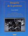 Imagerie de la prostate