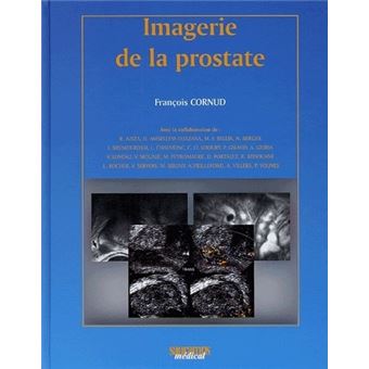 Imagerie de la prostate