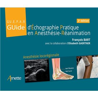 Guide D Echographie Pratique En Anesthesie Reanimation Anesthesie Locoregionale Broche Francois Bart Elisabeth Gaertner Achat Livre Fnac