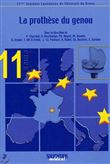 La prothese du genou