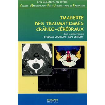 Imagerie des traumatismes cranio-cerebraux Tome 0000 - broché ...
