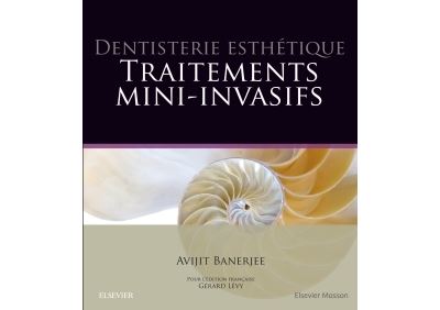 Dentisterie esthétique : traitements mini-invasifs