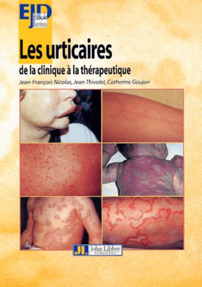 Les urticaires