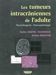 Les tumeurs intracraniennes de l adulte