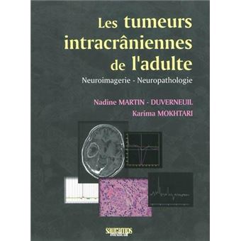 Les tumeurs intracraniennes de l adulte