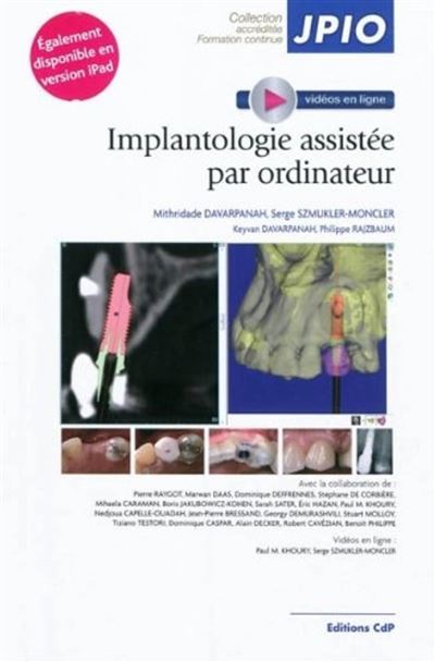 Implantologie assistee par ordinateur