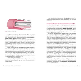 Comment échapper à l'infarctus et l'AVC