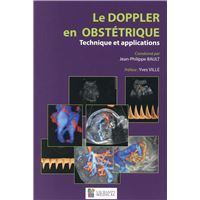 Le doppler en obstetrique. technique et applications