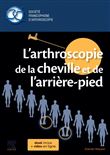 L'arthroscopie de la cheville et de l'arrière-pied