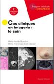 Cas cliniques en imagerie : le sein