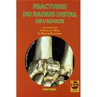 Fractures du radius distal de l adulte