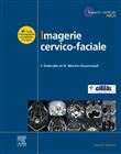Imagerie cervicofaciale