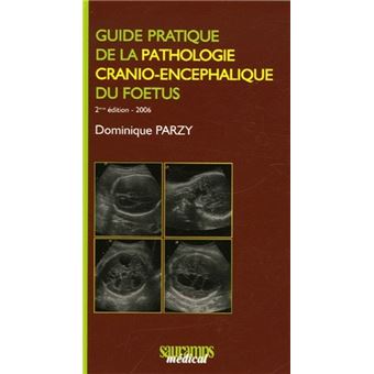 Guide pratique de la pathologie cranio encephalique