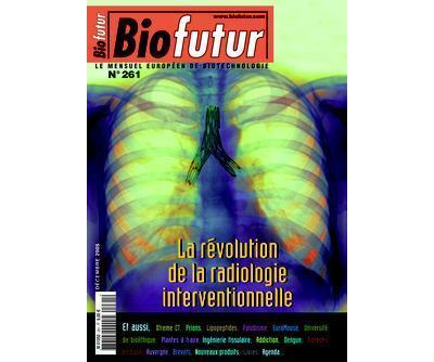 Biofutur:  La révolution de la radiologie interventionnelle