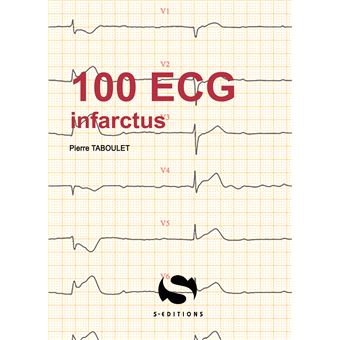 100 ECG autour de l'infarctus