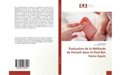 Evaluation de la methode de ponseti dans le pied bot varus e