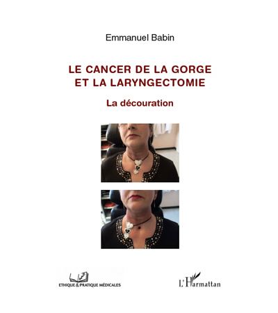 Le cancer de la gorge et la laryngectomie : la découration