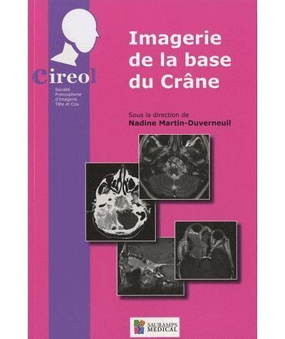 Imagerie de la base du crane - Nadine Martin-Duverneuil - broché