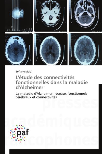 L'etude des connectivites fonctionnelles dans la maladie d'a