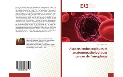 Aspects endoscopiques et anatomopathologiques cancer de l'œsophage