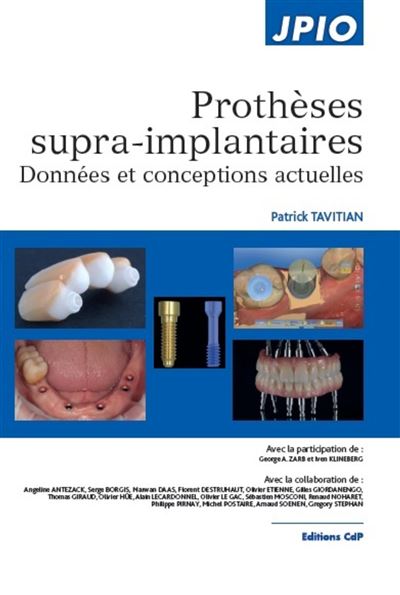 La prothèse supra-implantaire