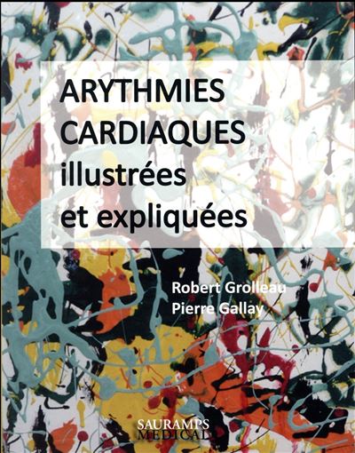 Arythmies cardiaques illustrées et expliquées