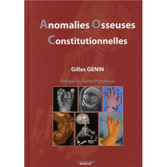 Anomalies osseuses constiutionnelles