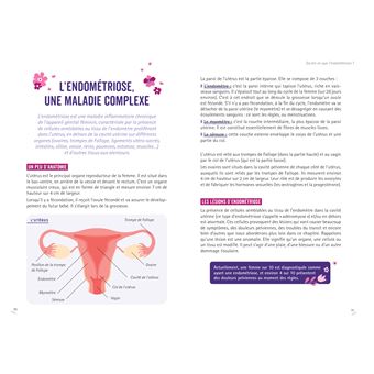 Soulager l'endométriose grâce à une alimentation anti-inflammatoire