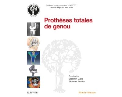 Prothèses totales de genou