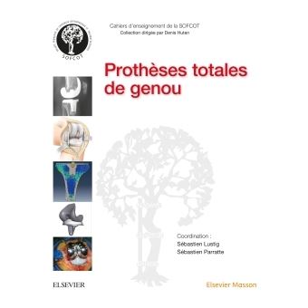 Prothèses totales de genou