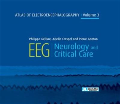 Atlas of électroencéphalographie