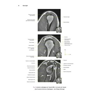 Anatomie descriptive et topographique des membres