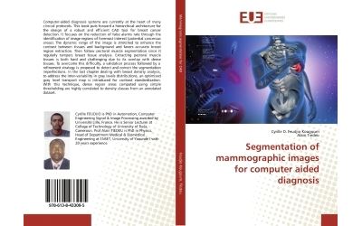 Segmentation of mammographic images for computer aided diagnosis